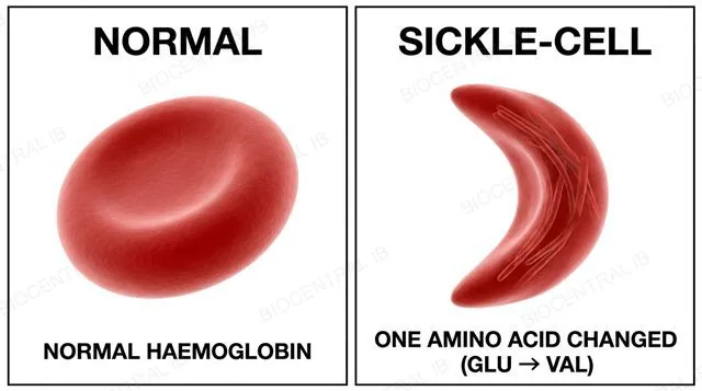 Primary structure as a sequence of amino acid beads determining a folded three-dimensional conformation, with normal and sickled red blood cells showing the effect of one amino acid change from glutamic acid to valine