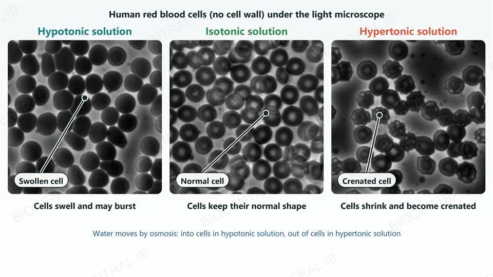 Three real light micrographs of human red blood cells: in a hypotonic solution the cells look swollen and rounded, in an isotonic solution they keep their normal shape, and in a hypertonic solution they are shrunken with a spiky, crenated surface; a leader in each panel points to a swollen, a normal and a crenated cell.