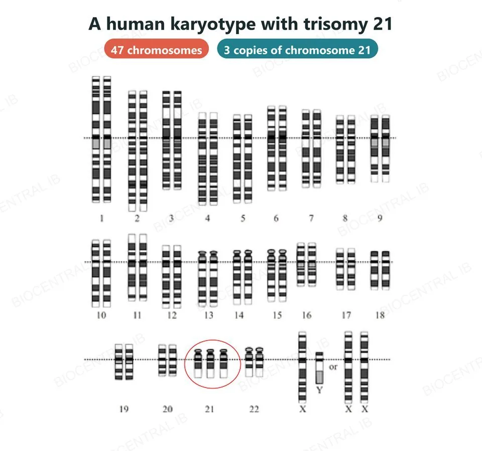 A human karyotype from a person with Down syndrome: the 22 pairs of autosomes, numbered 1 to 22 and drawn with their banding patterns, then the sex chromosomes (X and Y, or two X). Chromosome 21 appears three times instead of twice, ringed in red, giving 47 chromosomes in all. Two labels read 47 chromosomes and 3 copies of chromosome 21.