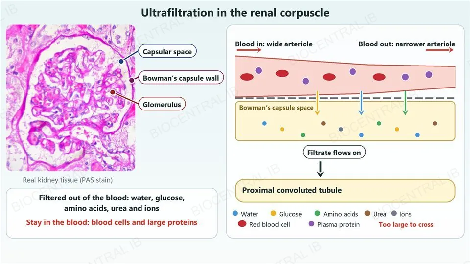 Left, a real micrograph of a renal corpuscle (PAS stain) with three labels and leader dots: the capsular space, the wall of Bowman’s capsule, and the glomerulus. Right, a diagram of a capillary running left to right, wide where blood comes in and narrower where it leaves, with red blood cells and purple plasma proteins staying inside it. Below its wall, coloured arrows show small molecules crossing into Bowman’s capsule space, where dots for water, glucose, amino acids, urea and ions collect; an arrow shows the filtrate flowing on into the proximal convoluted tubule. A card notes that water, glucose, amino acids, urea and ions are filtered out and that blood cells and large proteins stay in the blood.