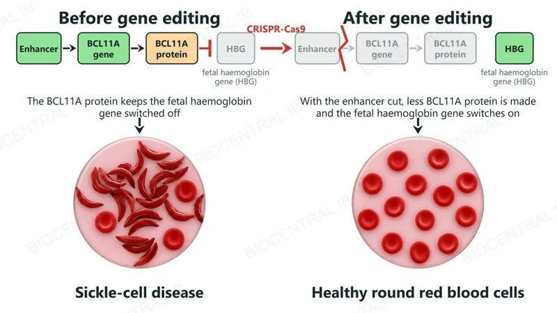 Before editing, the BCL11A enhancer drives the BCL11A gene, whose protein switches off the fetal haemoglobin gene, and sickle-shaped red blood cells are made; after CRISPR-Cas9 cuts the enhancer, less BCL11A protein is made, the fetal haemoglobin gene switches on and healthy round red blood cells are made