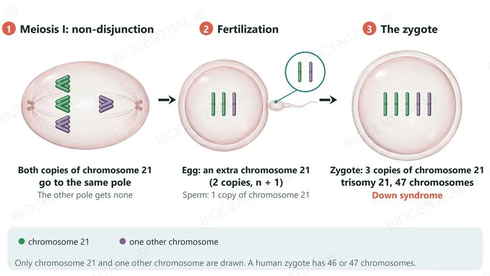 Three numbered stages. 1, meiosis I: an elongated cell in anaphase I in which both copies of chromosome 21 (green) move to the same pole and the other pole gets none. 2, fertilization: an egg with two copies of chromosome 21 (n + 1) meets a sperm with one copy. 3, the zygote has three copies of chromosome 21, trisomy 21, and 47 chromosomes: Down syndrome. A key shows chromosome 21 in green and one other chromosome in purple; only these two are drawn.