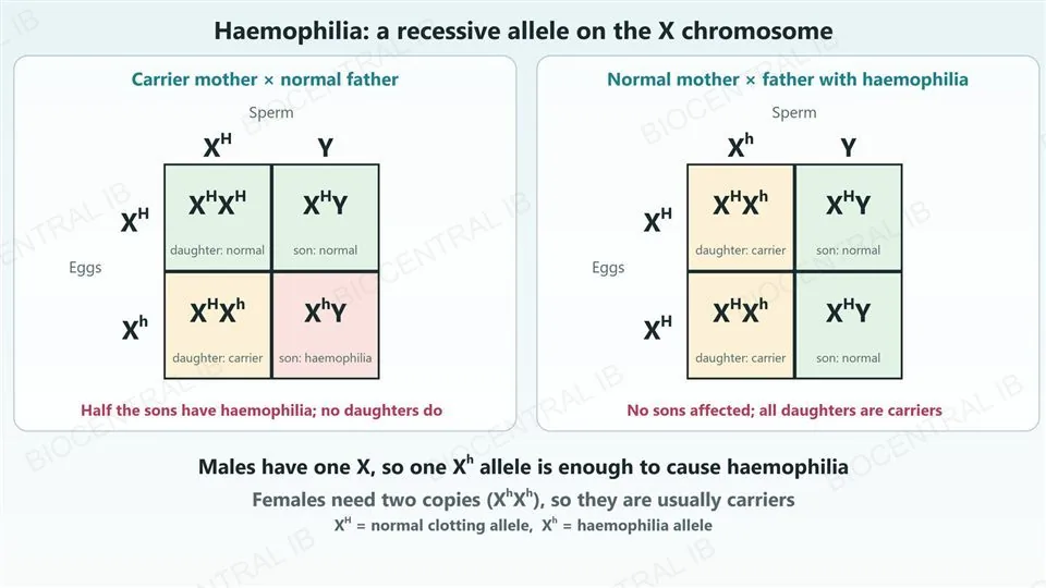Two Punnett grids. Left, a carrier mother X H X h and a normal father X H Y: daughters X H X H normal and X H X h carrier, sons X H Y normal and X h Y with haemophilia, so half the sons are affected and no daughters. Right, a normal mother X H X H and a father with haemophilia X h Y: all daughters X H X h carriers and all sons X H Y normal. A note says males need one X h allele but females need two.