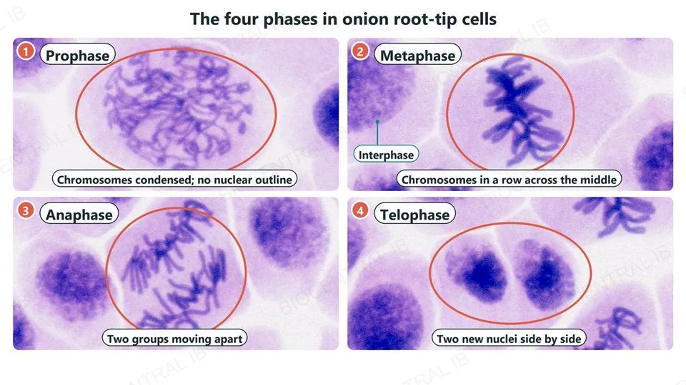 Four real light-microscope photographs of stained onion root-tip cells, numbered 1 to 4, each with the dividing cell ringed. Prophase: condensed thread-like chromosomes and no nuclear outline. Metaphase: the chromosomes in a row across the middle of the cell, with a nearby interphase nucleus labeled. Anaphase: two groups of chromatids moving apart. Telophase: two new nuclei side by side.