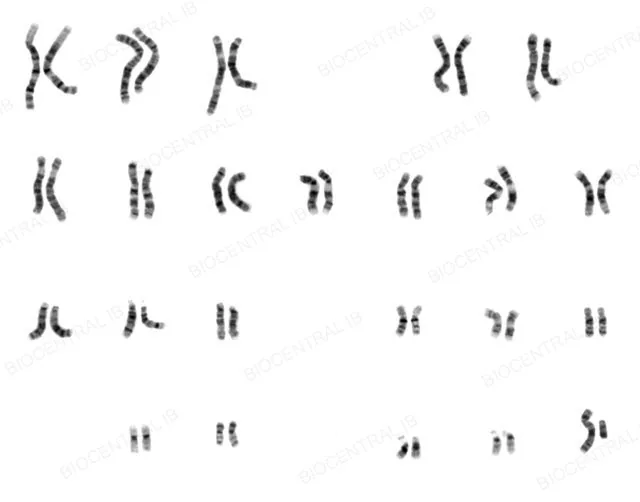 Photograph of an unsorted human male metaphase chromosome spread