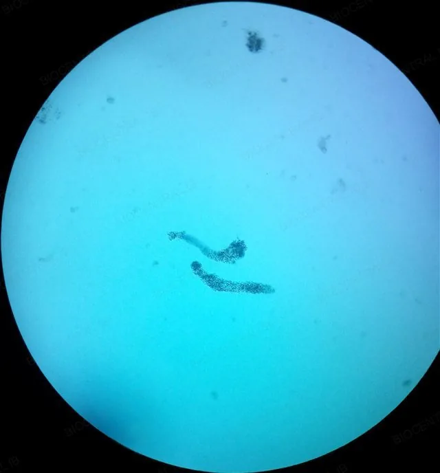 Amoeba proteus viewed under a light microscope, showing pseudopodia extending from the cell surface